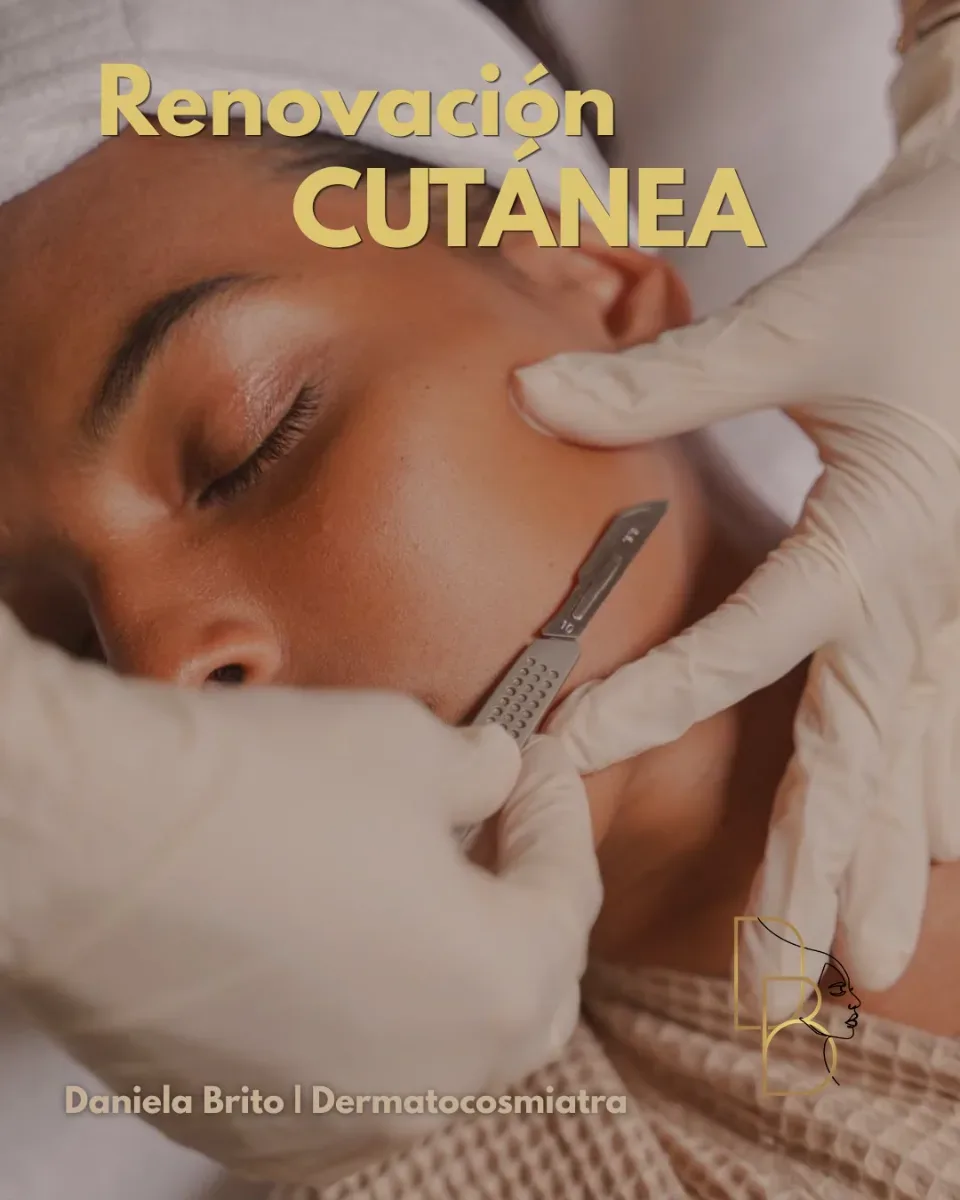 Julio | Renovación Cutánea Limpieza Facial Profunda + Dermaplaning 30% OFF