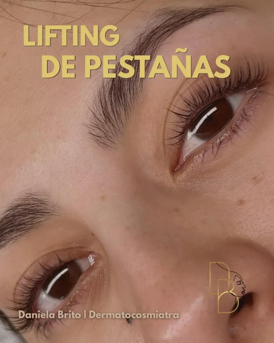 Lifting de Pestañas