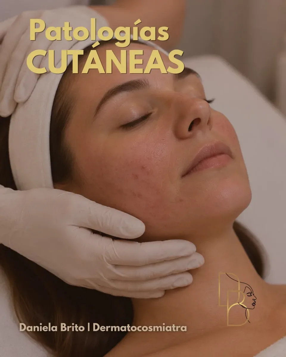 Patologías Cutáneas | Cuidado Dermatocosmiátrico