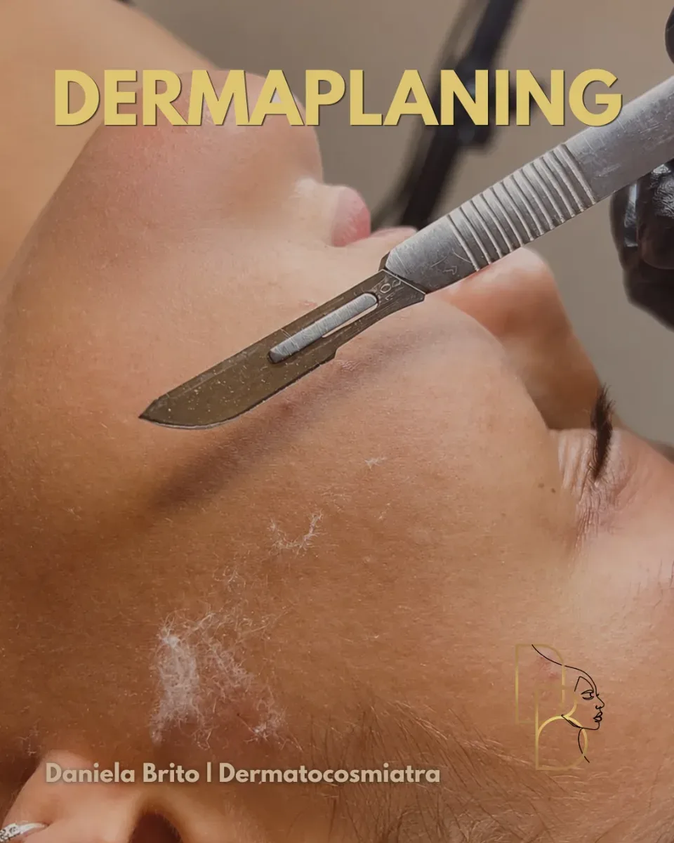 Dermaplaning