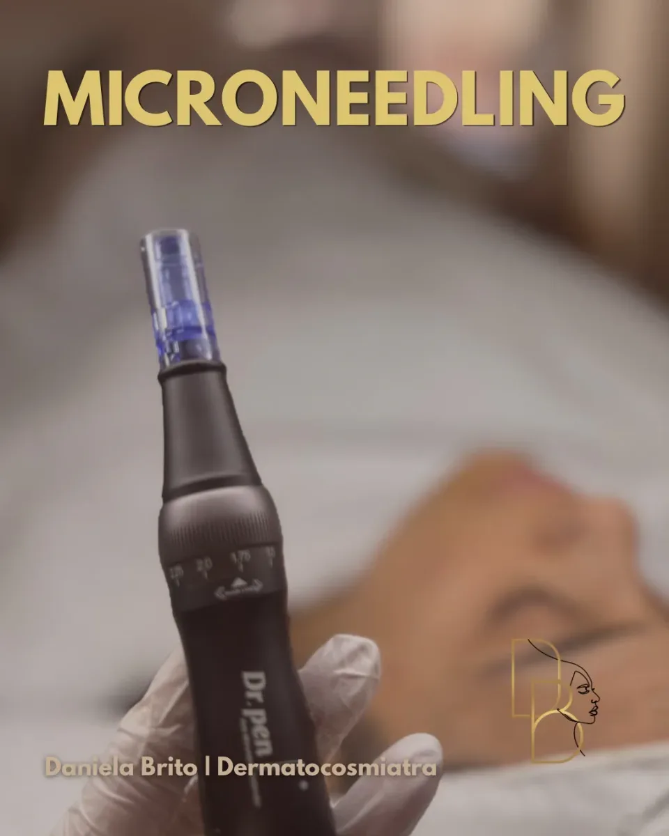 Microneedling