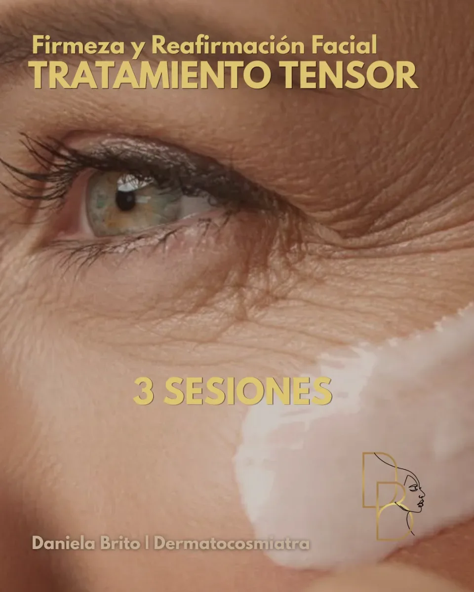 Tratamiento Tensor | Pack 3 sesiones 20% OFF