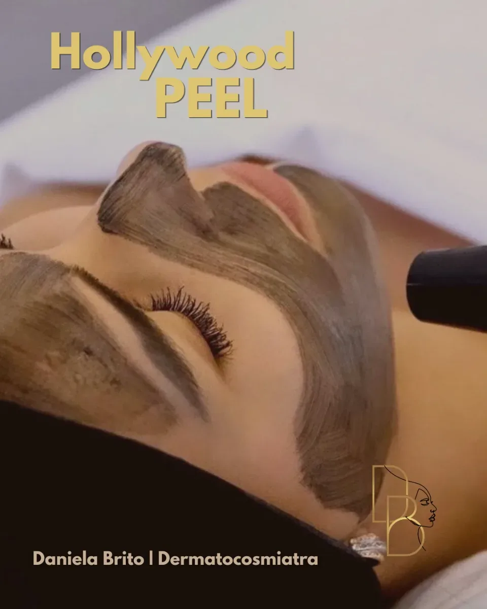 Julio | Hollywood Peel Laser Facial 30% OFF