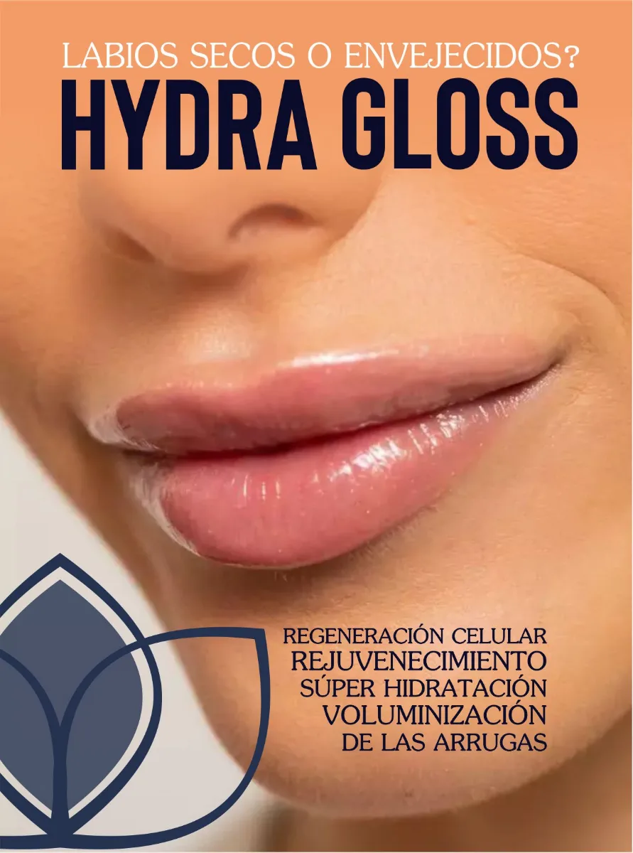 Hydra Gloss